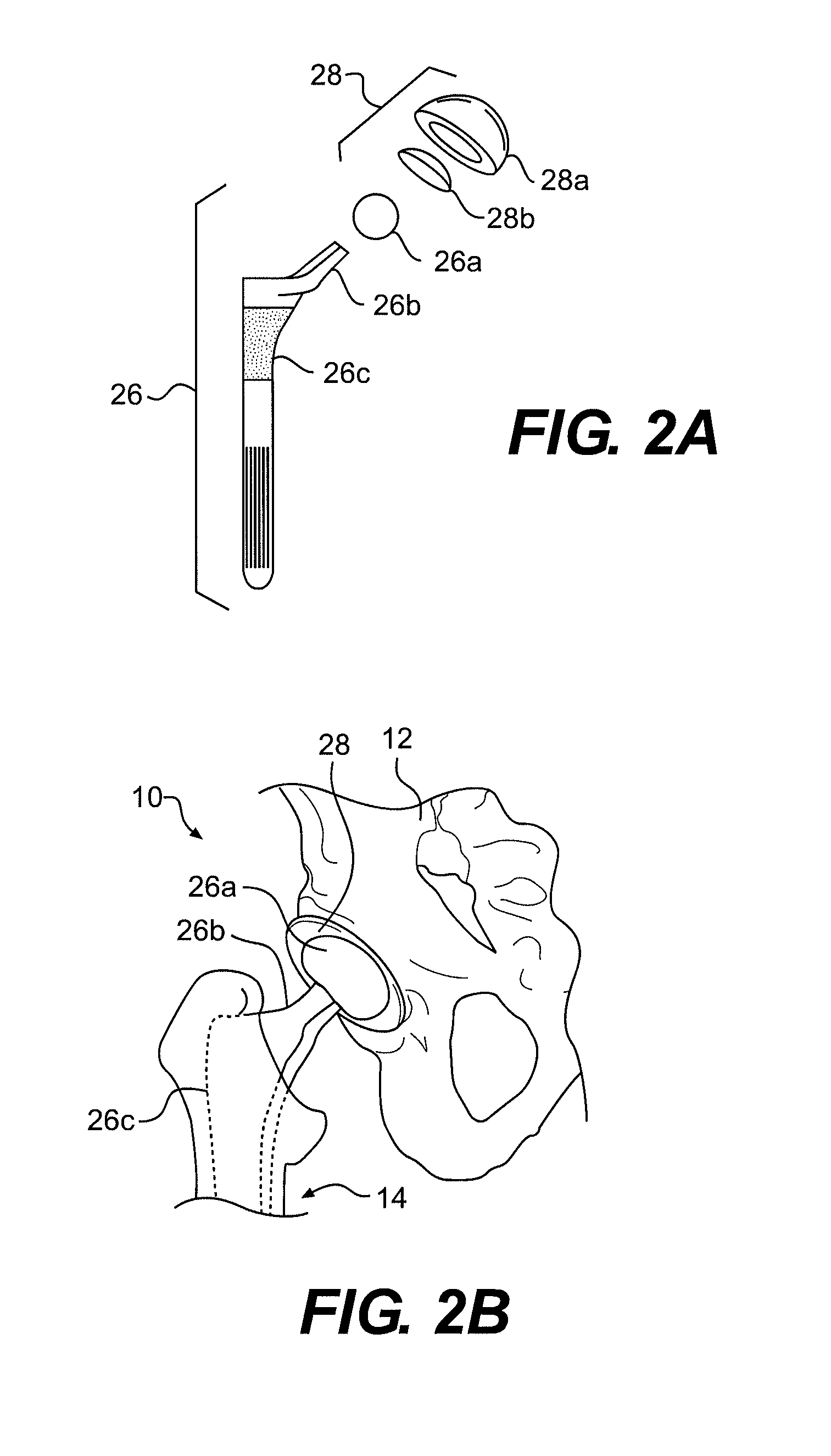 Systems and methods for measuring parameters in joint replacement surgery