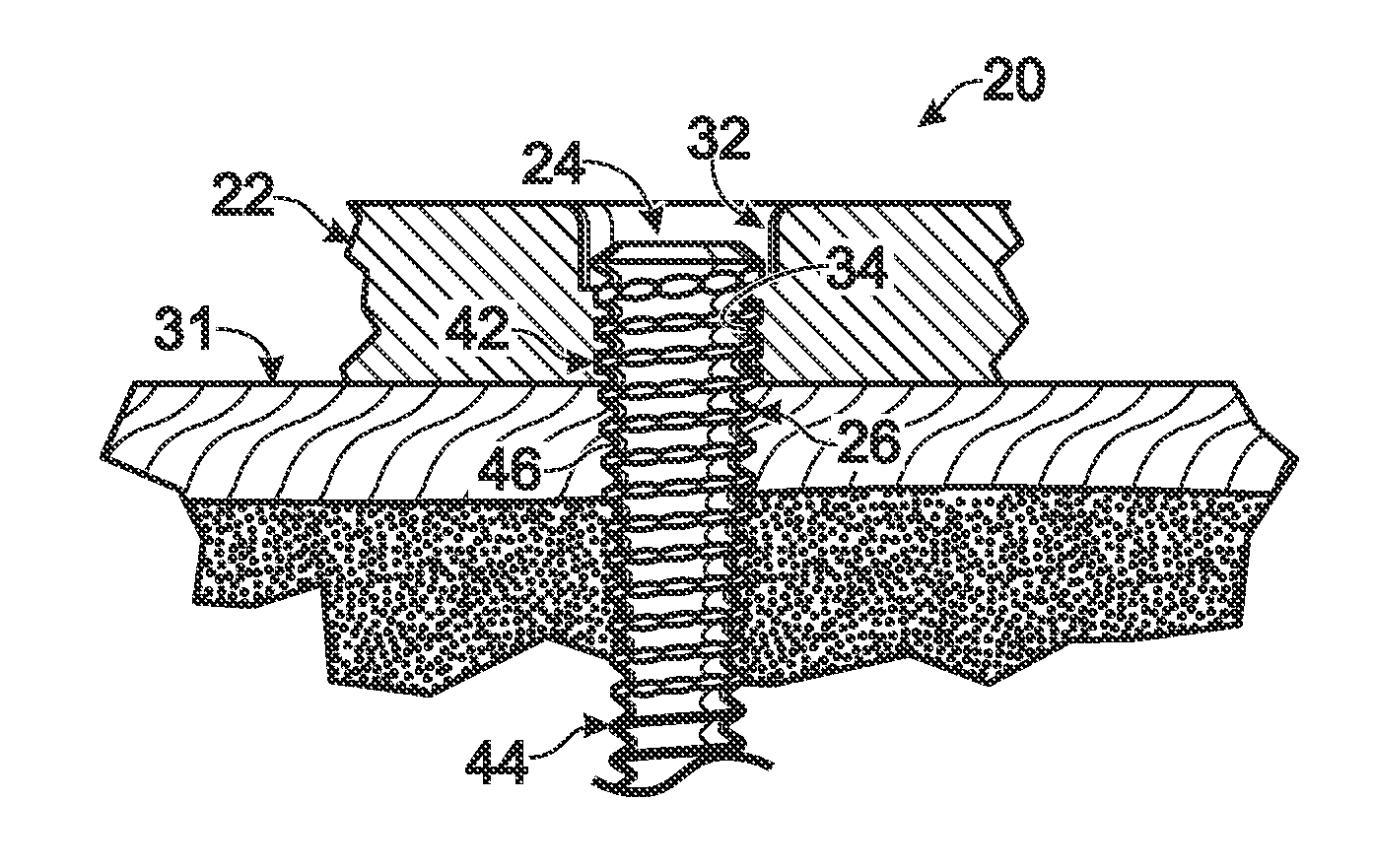 Fastener with serrated thread for attachment to a bone plate at a selectable angle