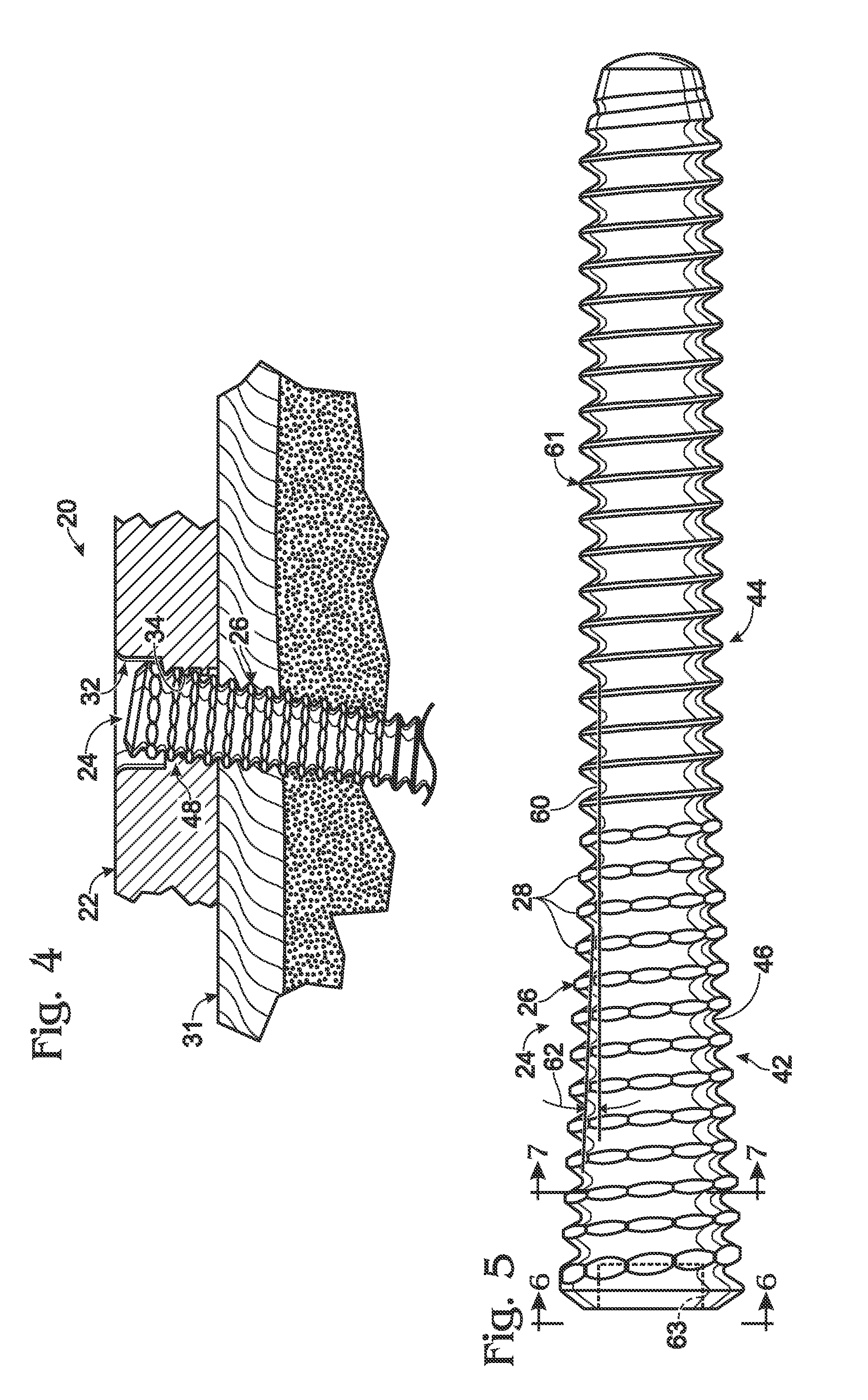 Fastener with serrated thread for attachment to a bone plate at a selectable angle
