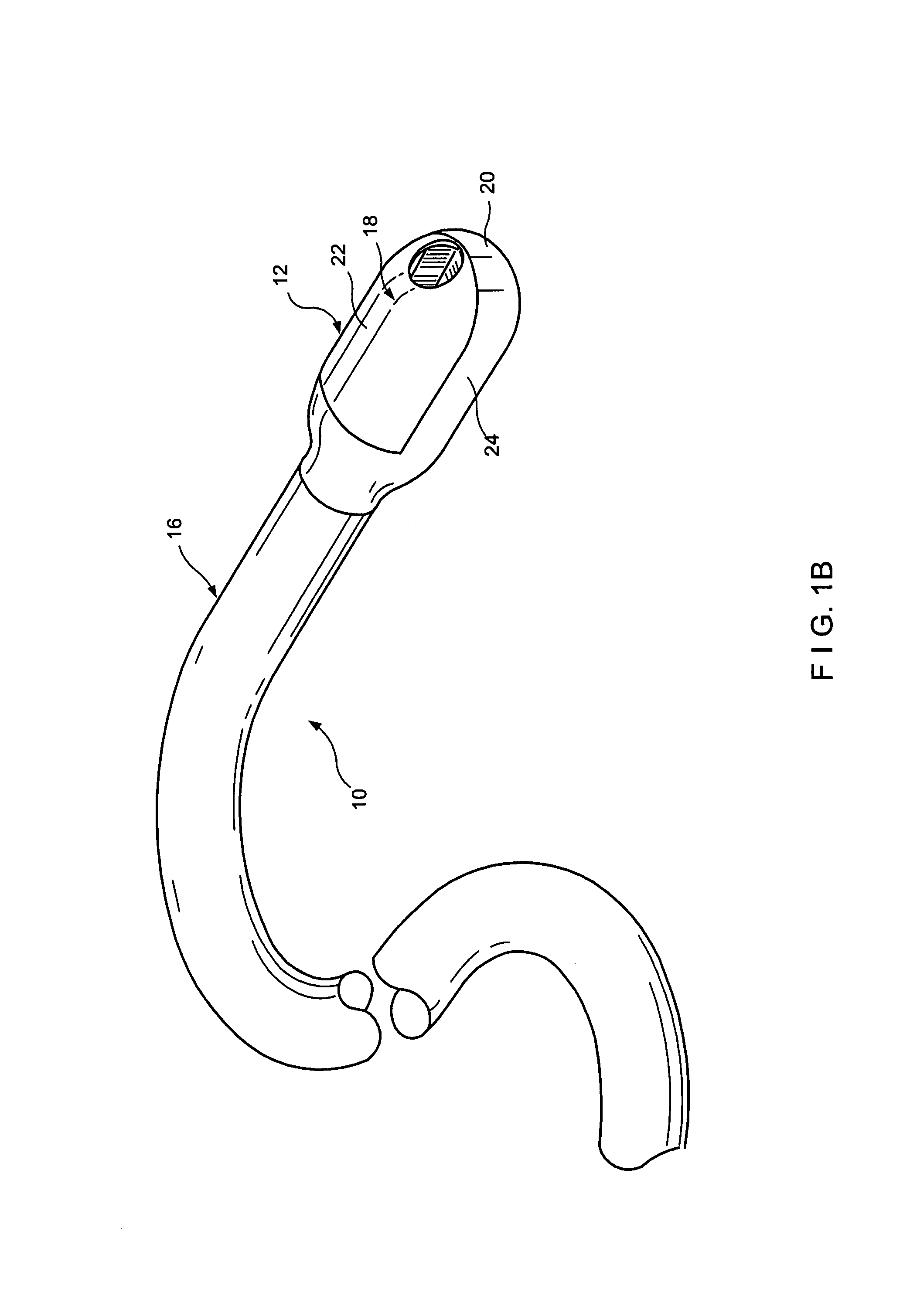 Surgical apparatus and method
