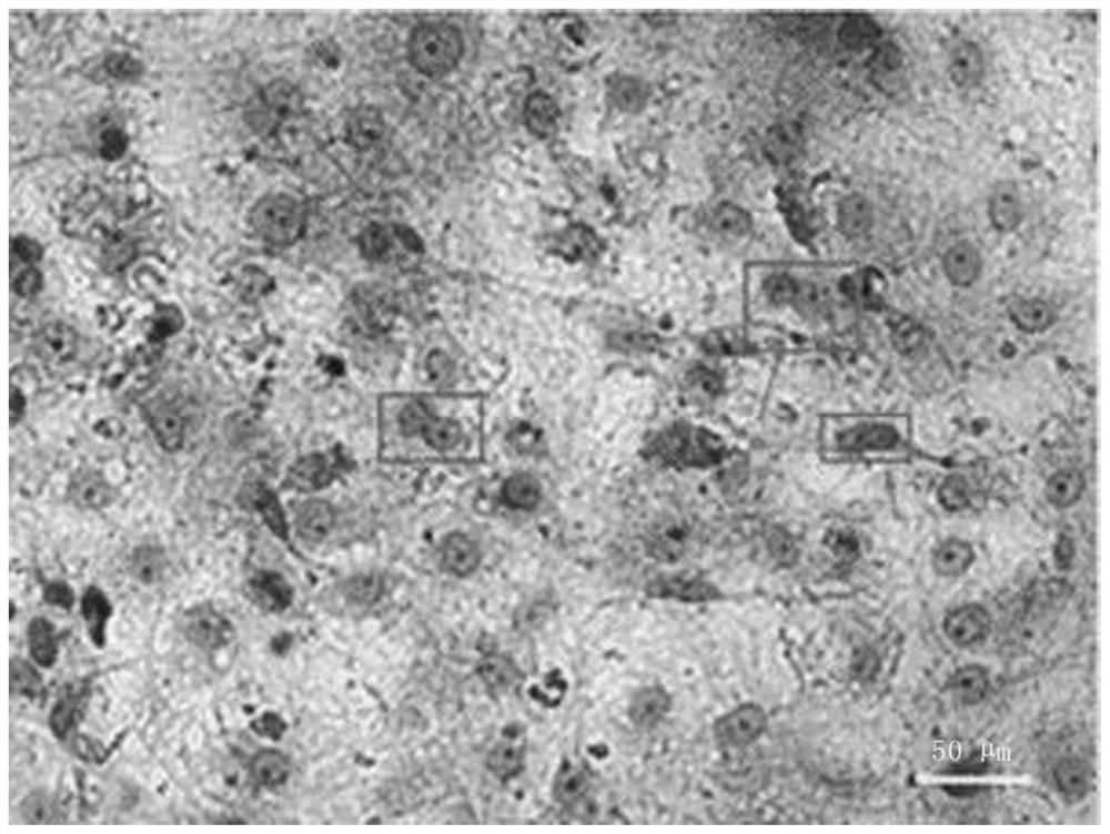 Induced differentiation method for efficiently shaping entoderm cells