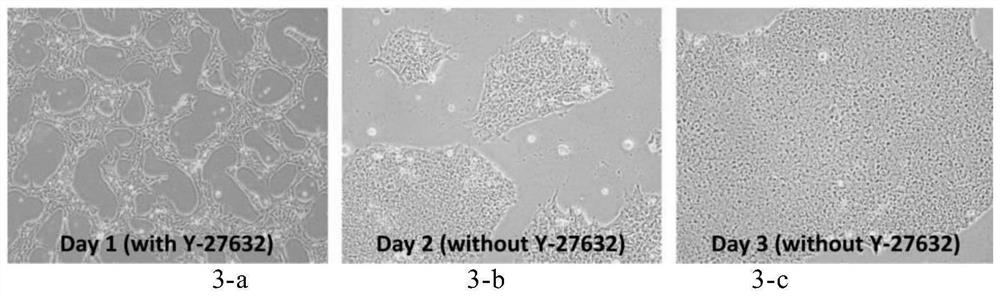 Culture media and applications thereof, and differentiation methods of induced pluripotent stem cells into pancreatic islets