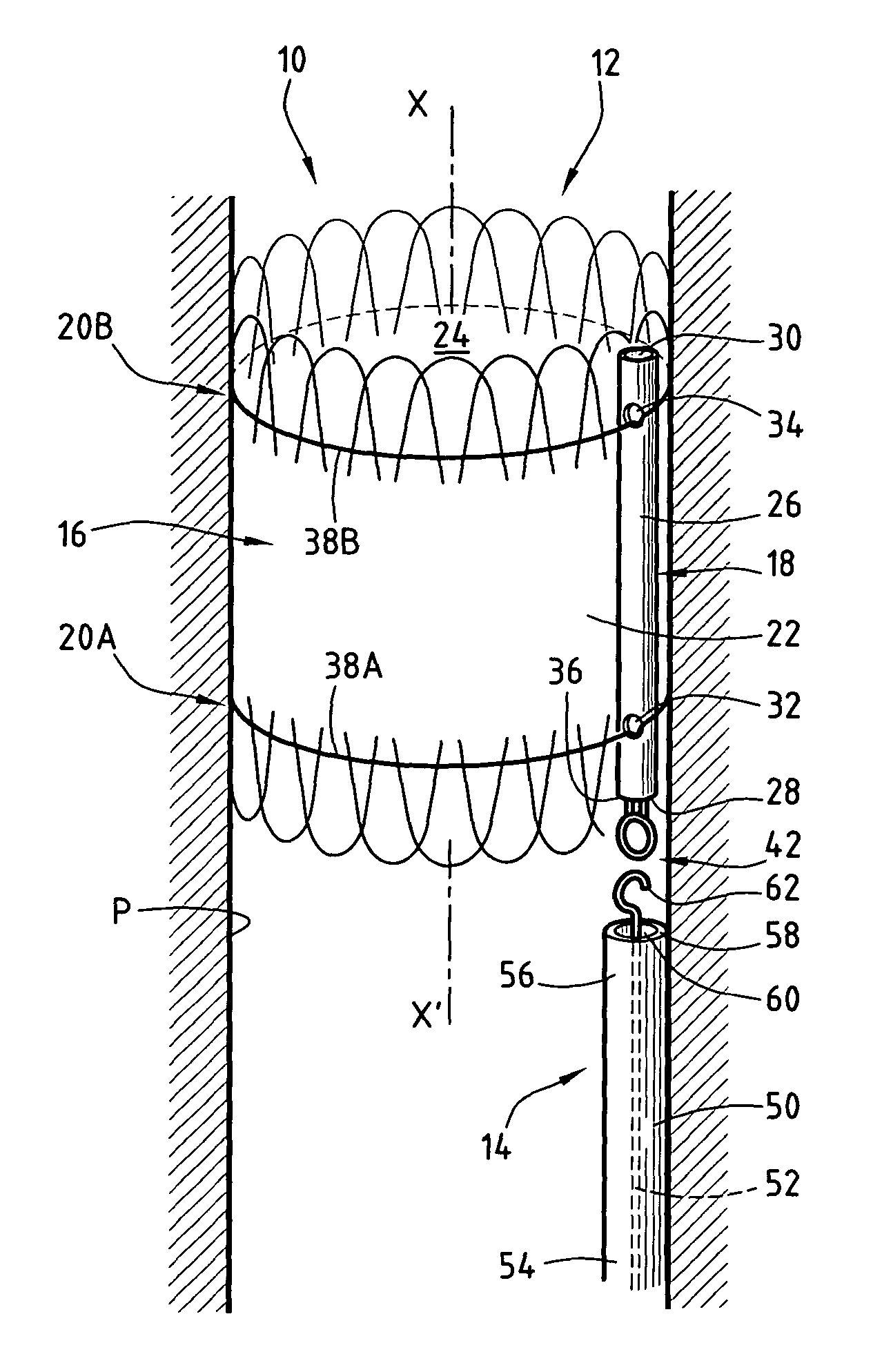 Device for treating a blood vessel and associated treatment kit