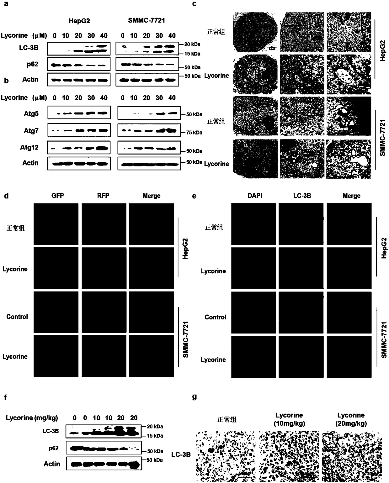 Application of autophagy inhibitor to preparation of medicament for reinforcing anti-hepatoma activity of lycorine