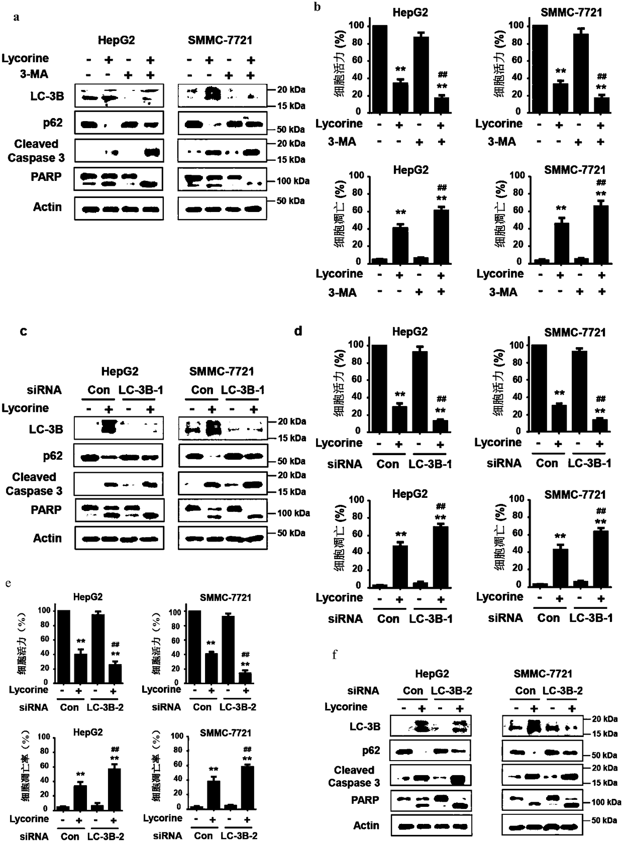 Application of autophagy inhibitor to preparation of medicament for reinforcing anti-hepatoma activity of lycorine