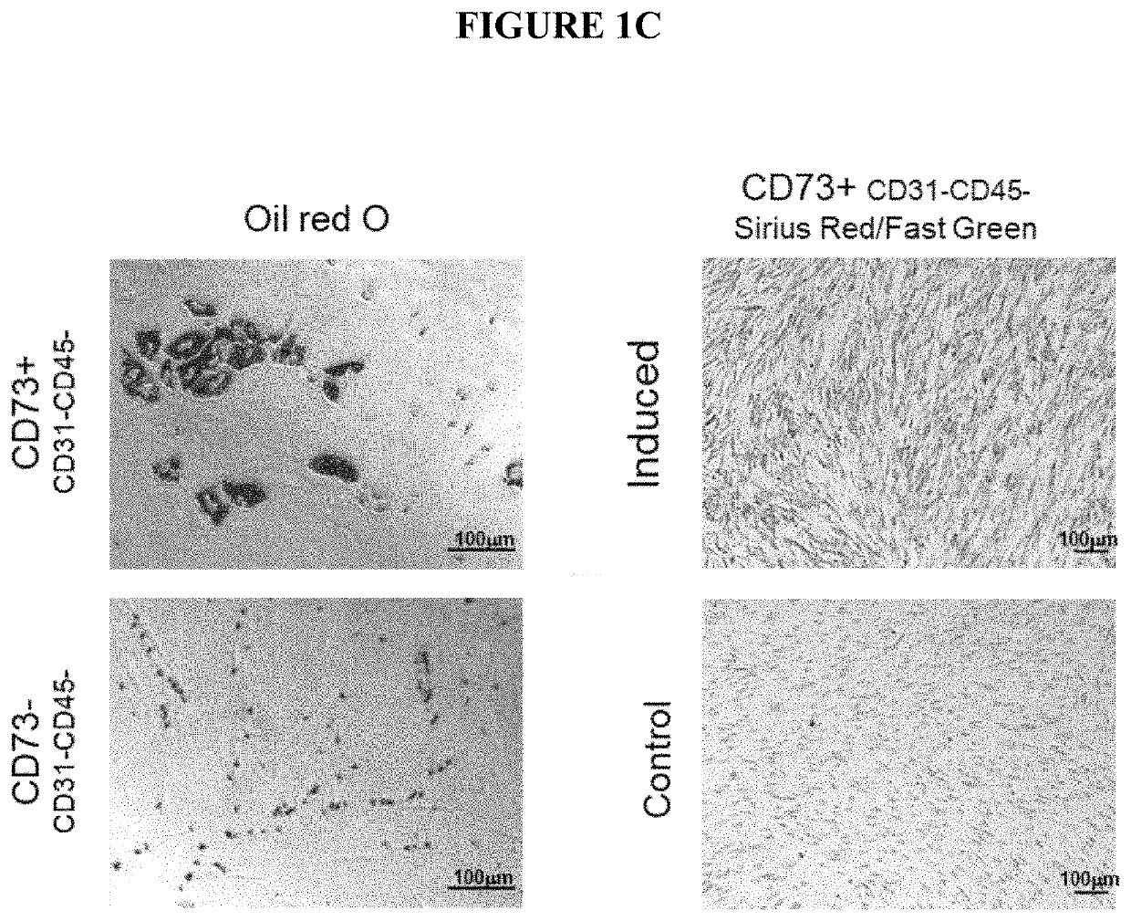 Methods for producing fibroadipogenic progenitor cells