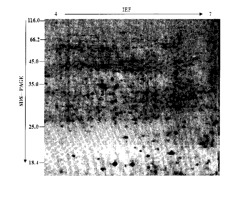 Dimensional electrophoresis method for total protein of jute root system