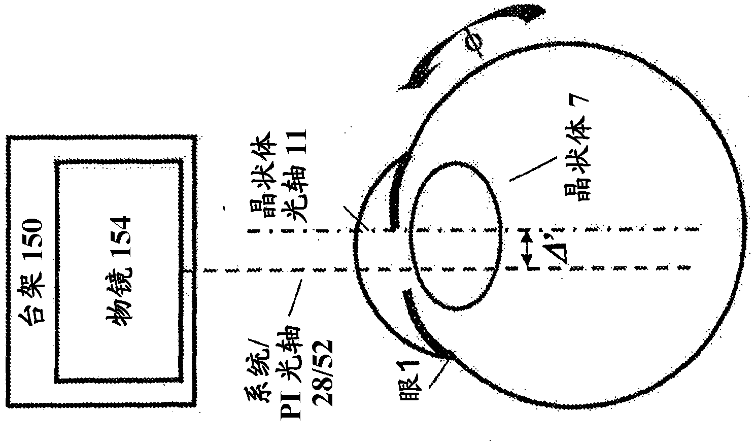 Imaging-based guidance system for ophthalmic docking using a location-orientation analysis