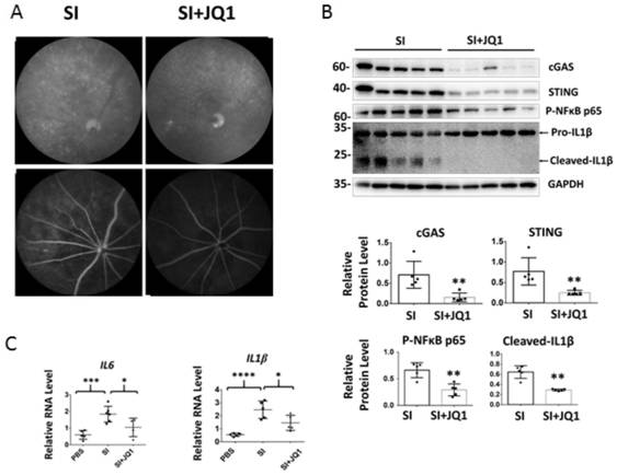 Applications of small molecule drug (+)-JQ1 in drugs for treating geographic atrophy type age-related macular degeneration