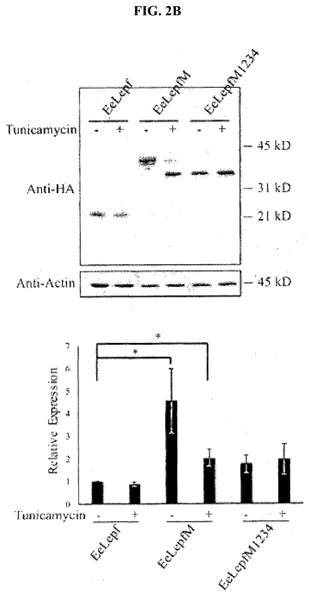 Recombinant vector for expressing target protein in plant cell