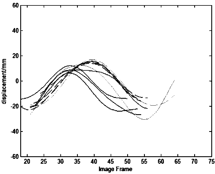 Separation estimation method of multiple motion parameters in X-ray angiographic image