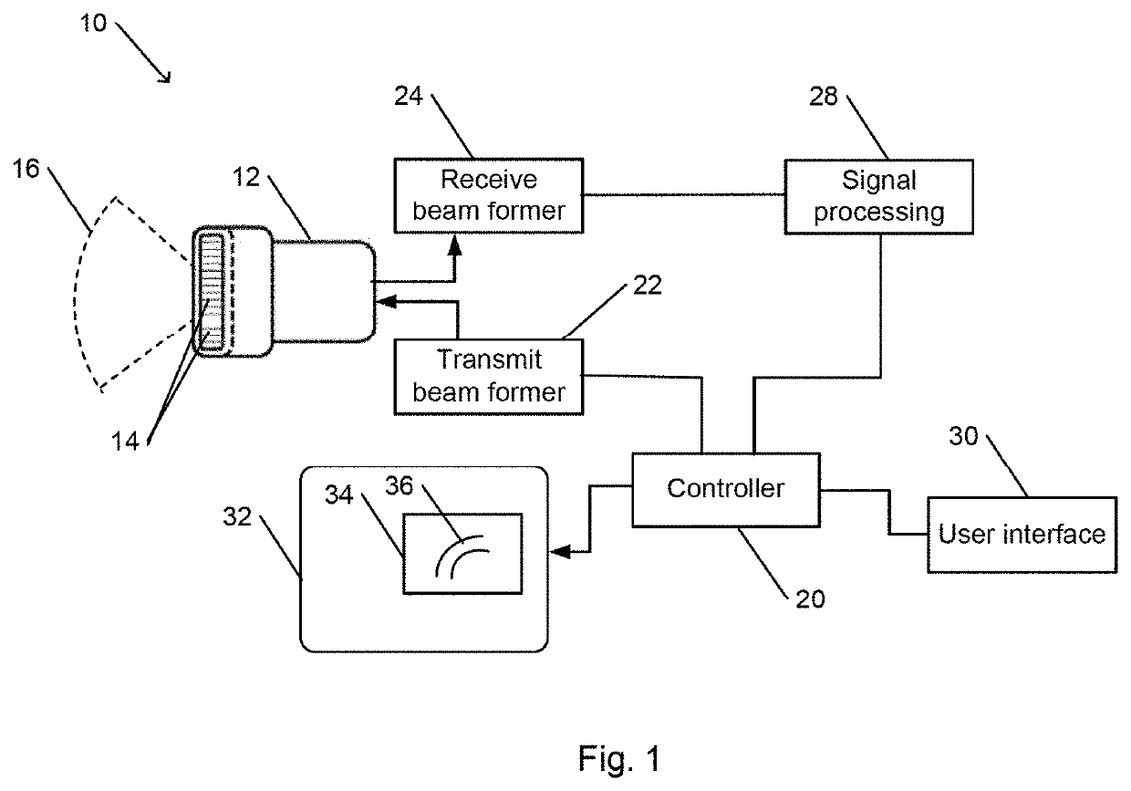 Systems and methods for hand-free continuous ultrasonic monitoring