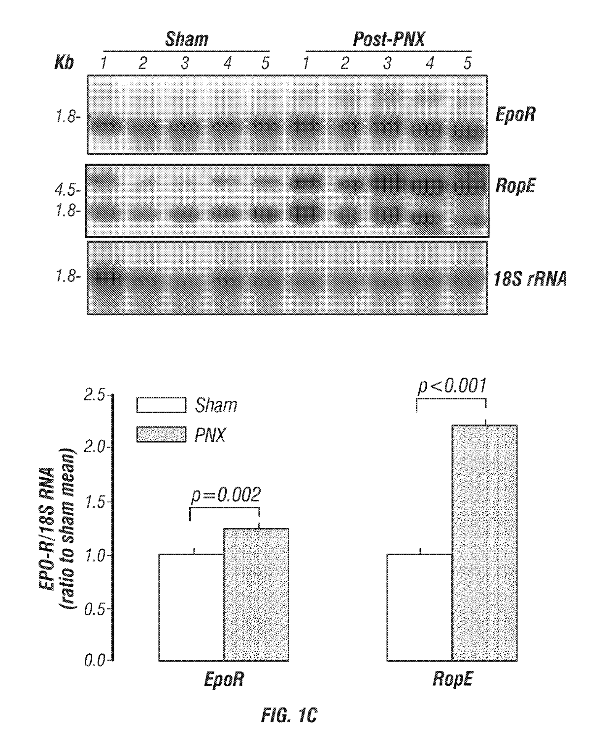 Compositions comprising antisense-encoded erythropoietin receptor and use thereof