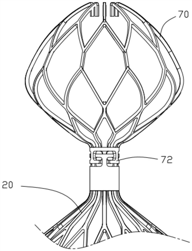 Left auricle ablation plugging device