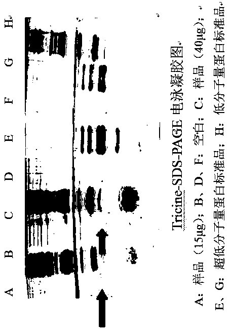 Method for purifying interest protein in serum of patient with liver cancer through electrophoretic separation