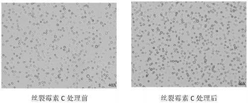 Treatment method for de-proliferation ability of feeder cells for NK cell culture