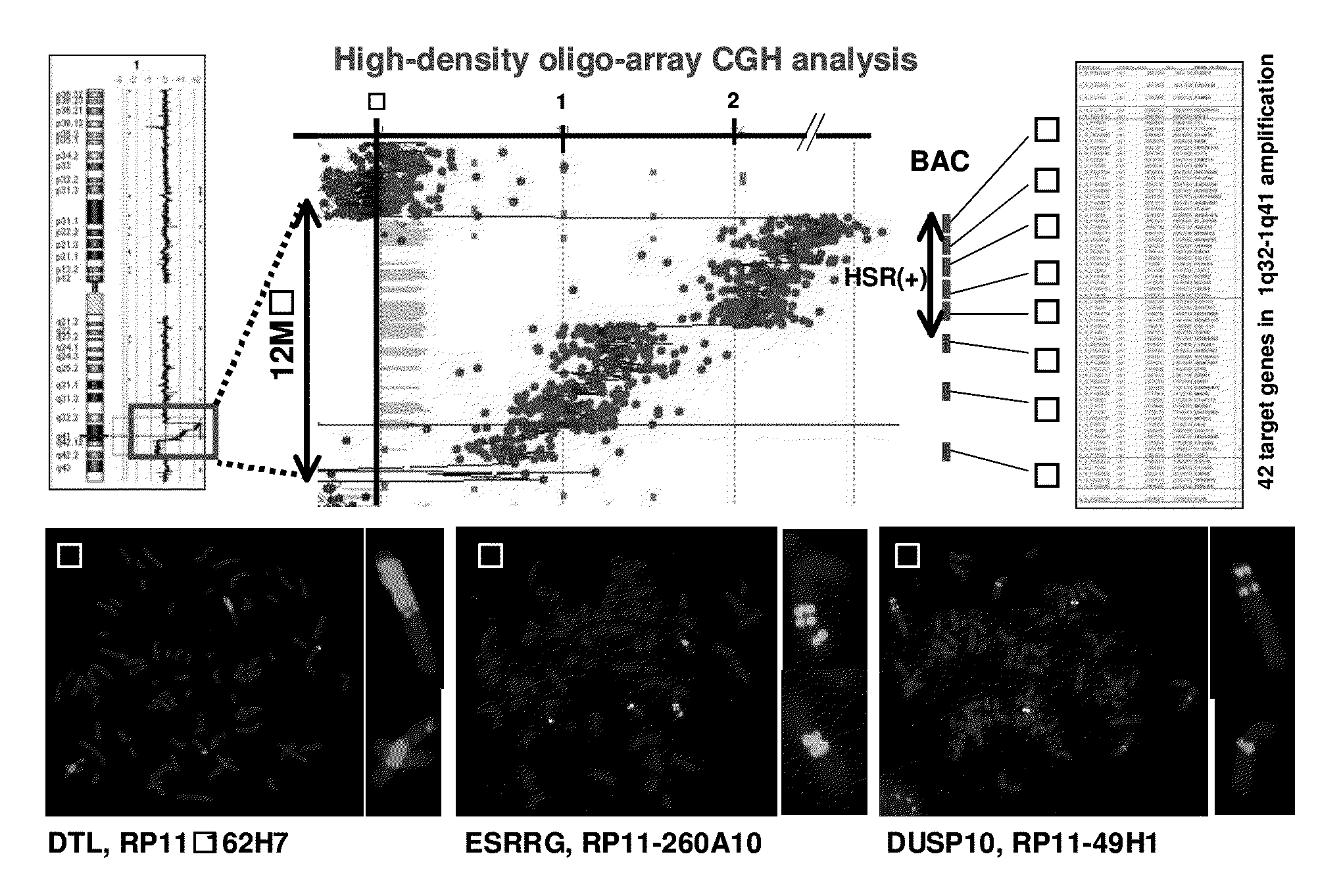 Method for detecting esophageal carcinoma and agent for suppressing esophageal carcinoma