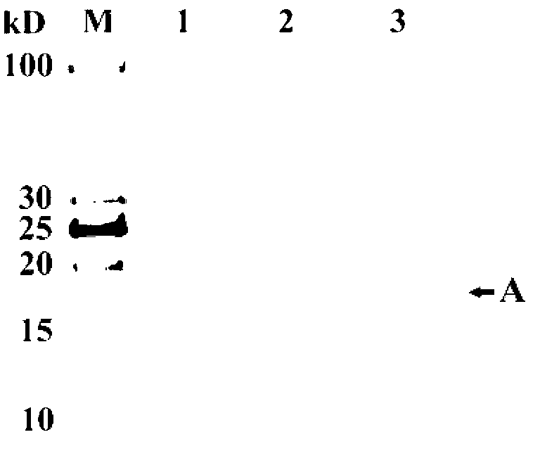 Immobilization method of Thermus lipase
