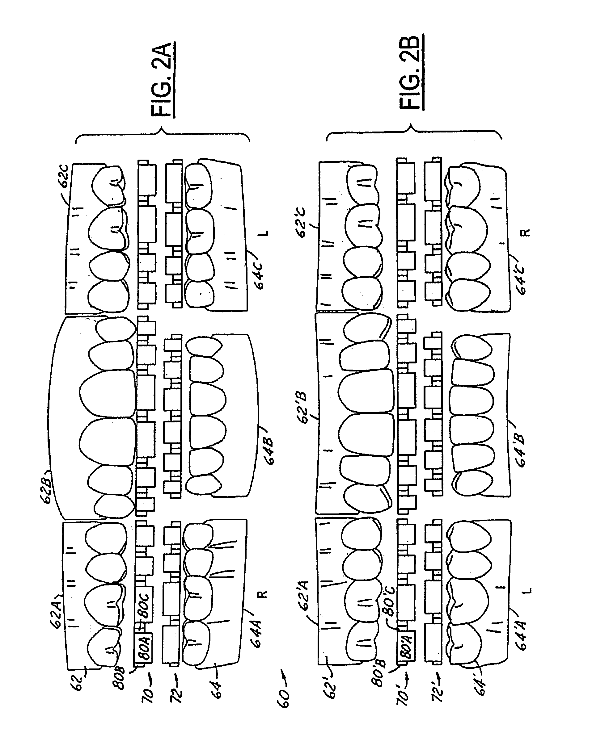 Method and system for periodontal charting