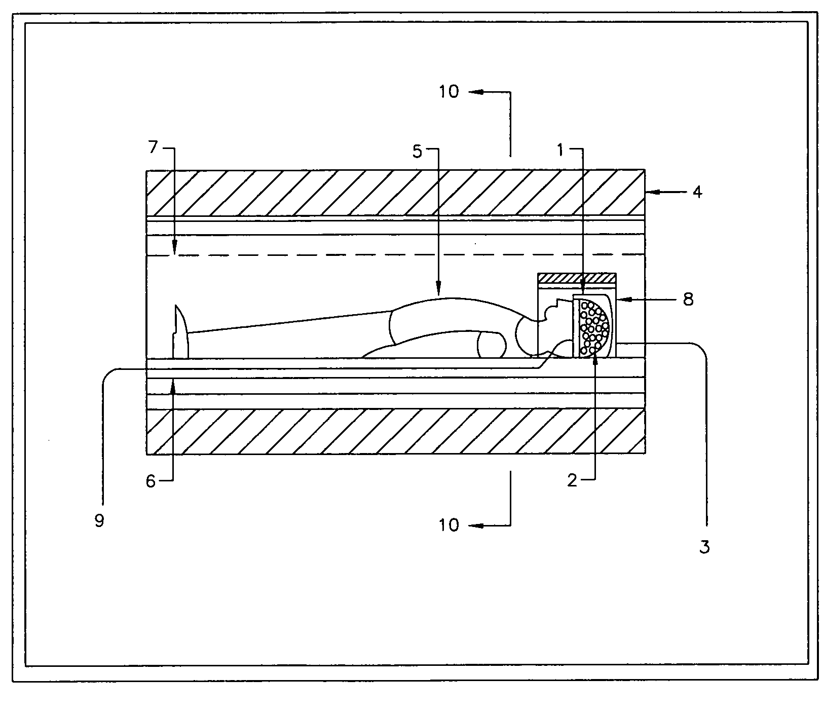 Methods for modifying electrical currents in neuronal circuits