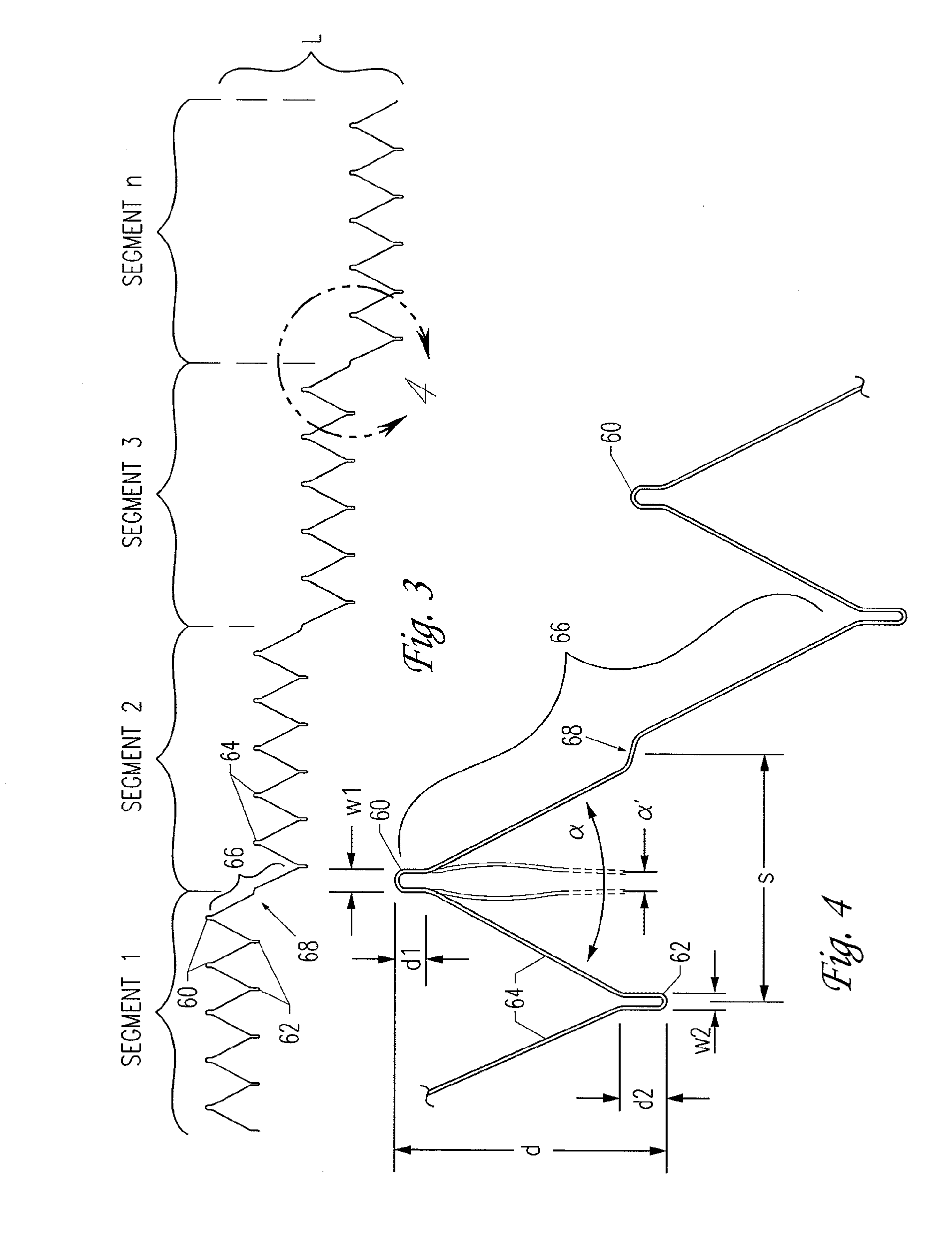 Implantable vascular graft