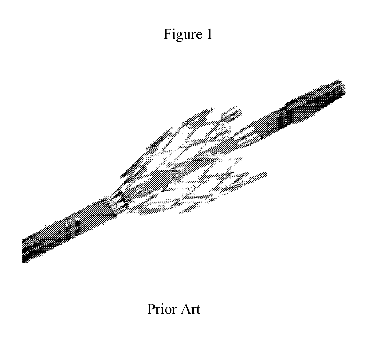 Highly retractable intravascular stent conveying system
