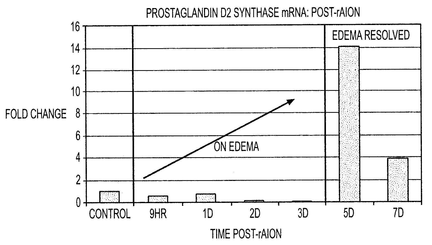 Compositions and methods for treatment of optic nerve diseases