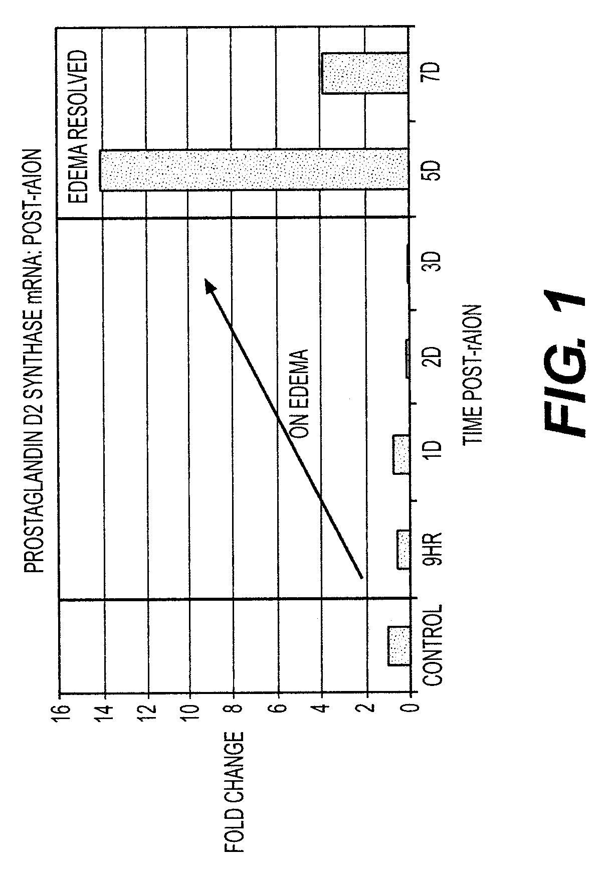 Compositions and methods for treatment of optic nerve diseases