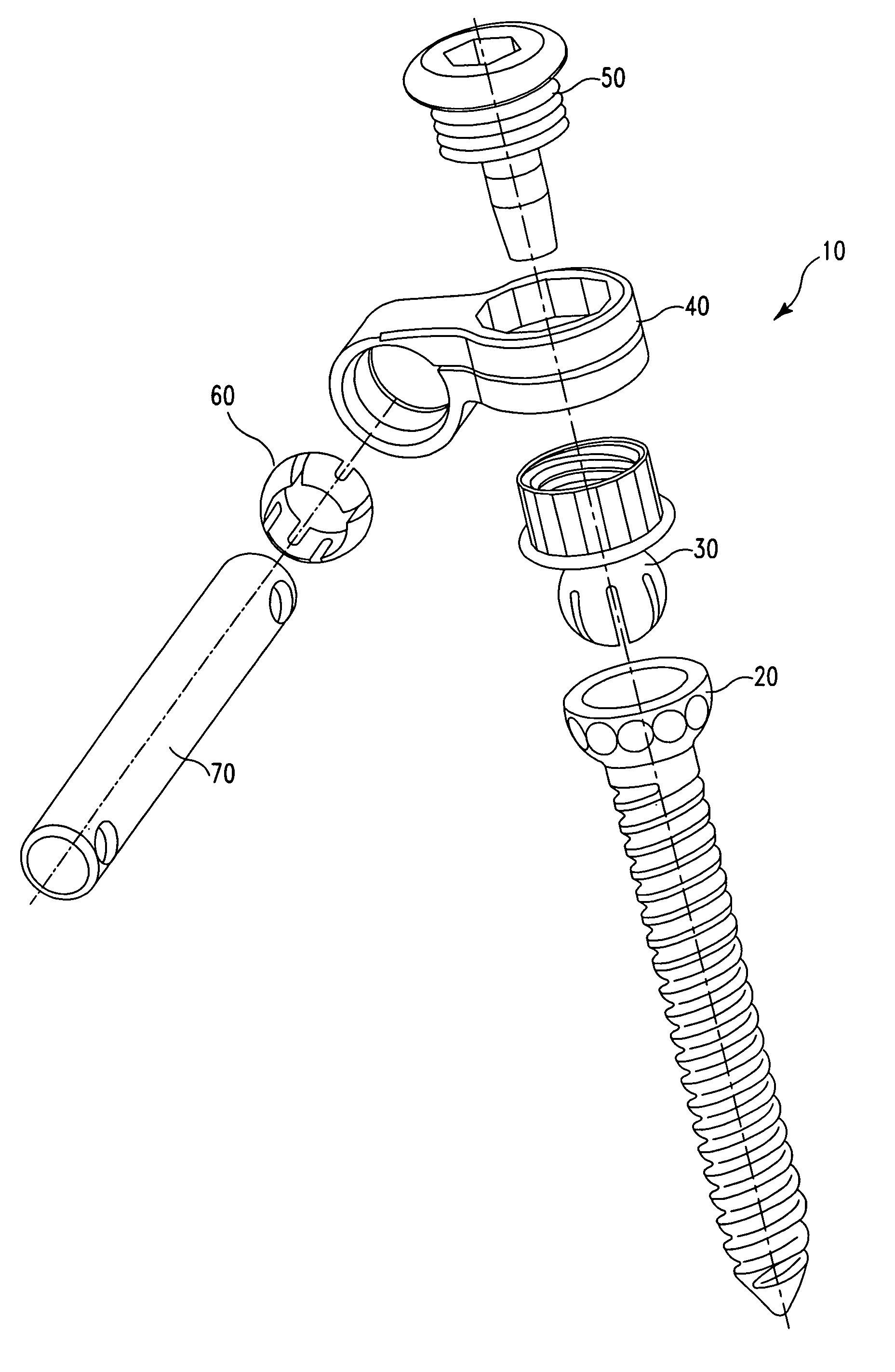 Medialised rod pedicle screw assembly