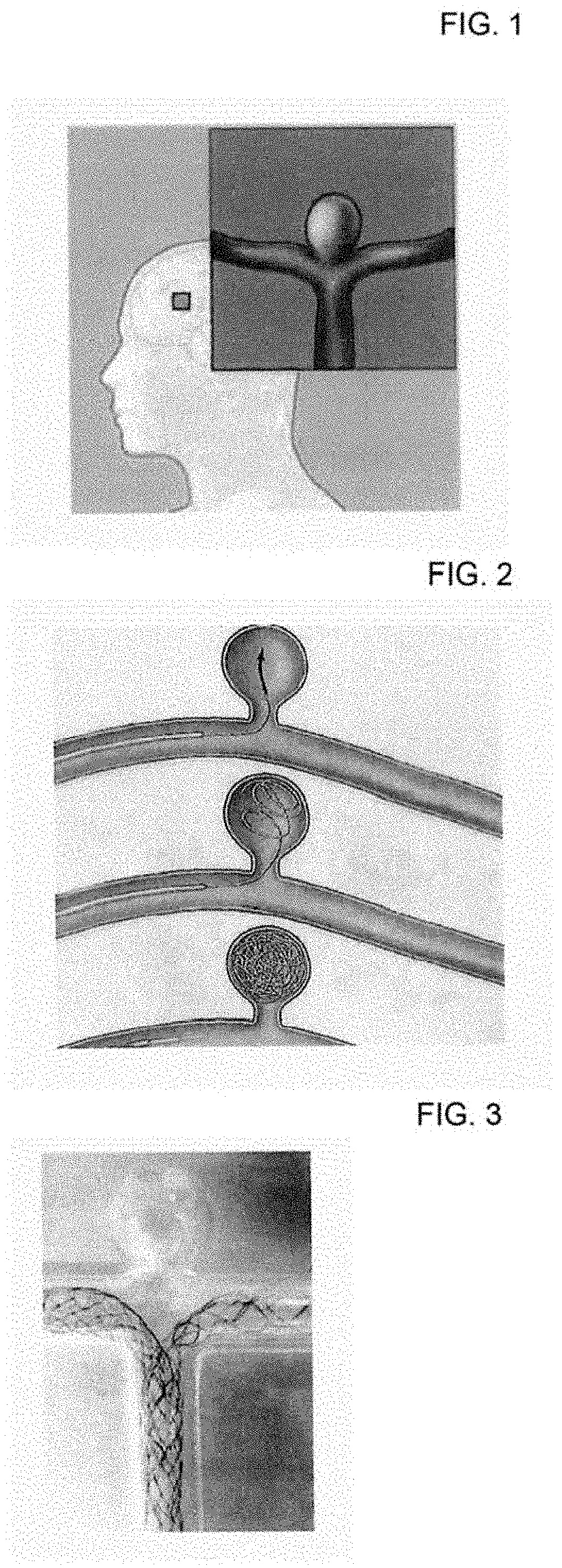 Cerebral aneurysm stent and manufacturing method therefor