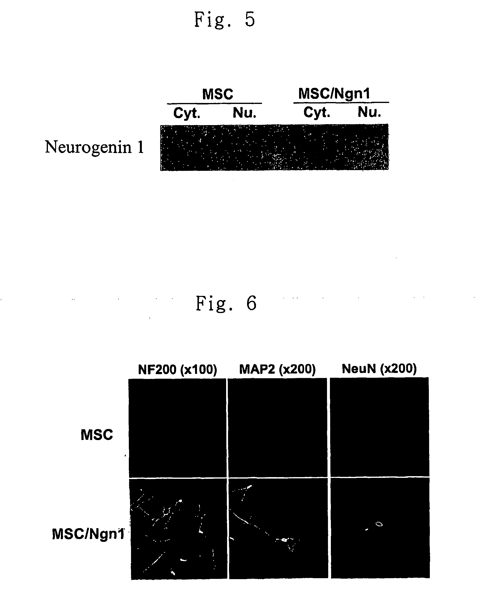 Method for transdifferentiating mesenchymal stem cells into neuronal cells