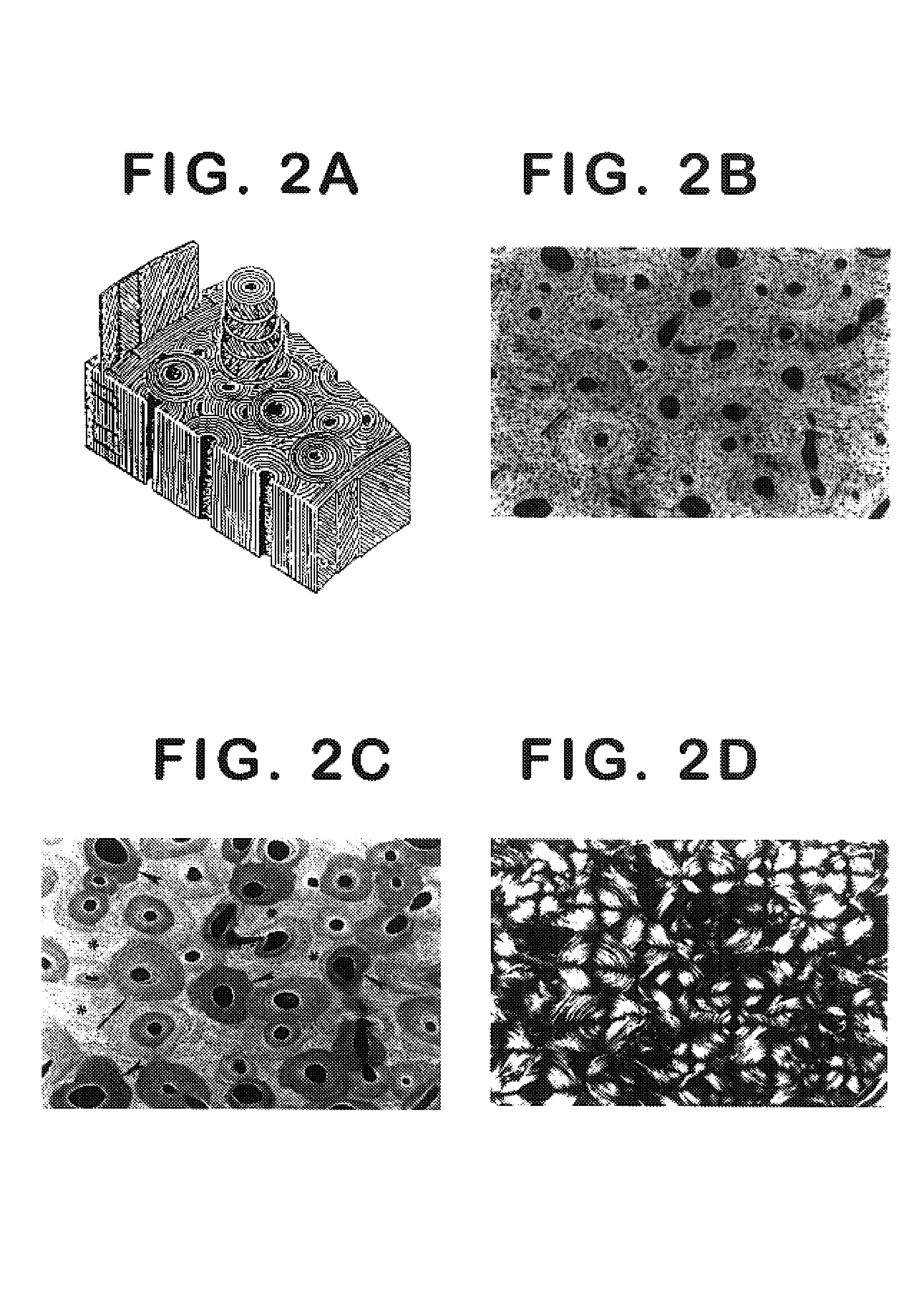 System and method for modeling bone structure
