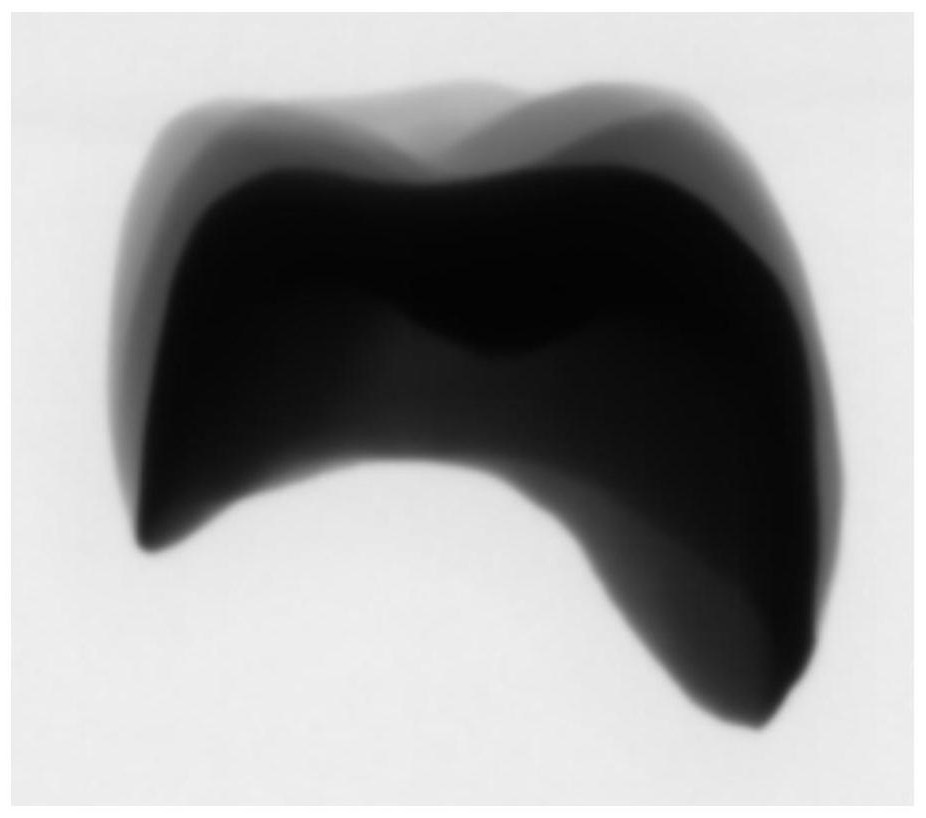 Detection method for internal defects of zirconia double-layer all-ceramic restorations