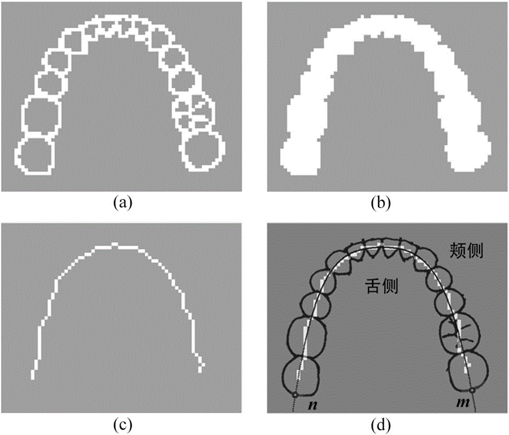 Triangular grid tooth segmentation method based on path planning