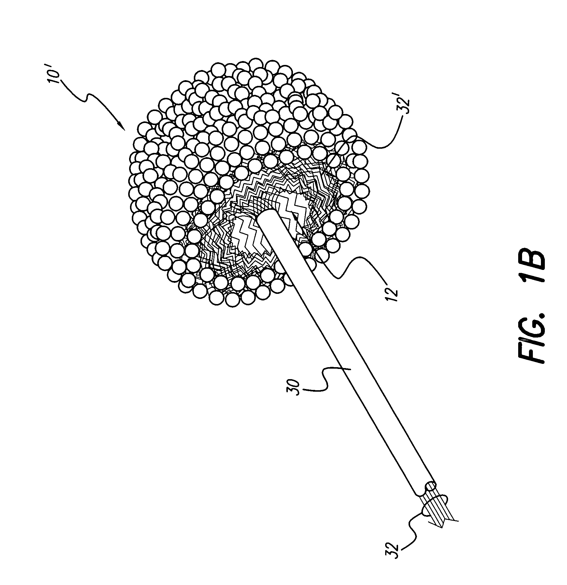 Soft, middle-ear electrode for suppressing tinnitis