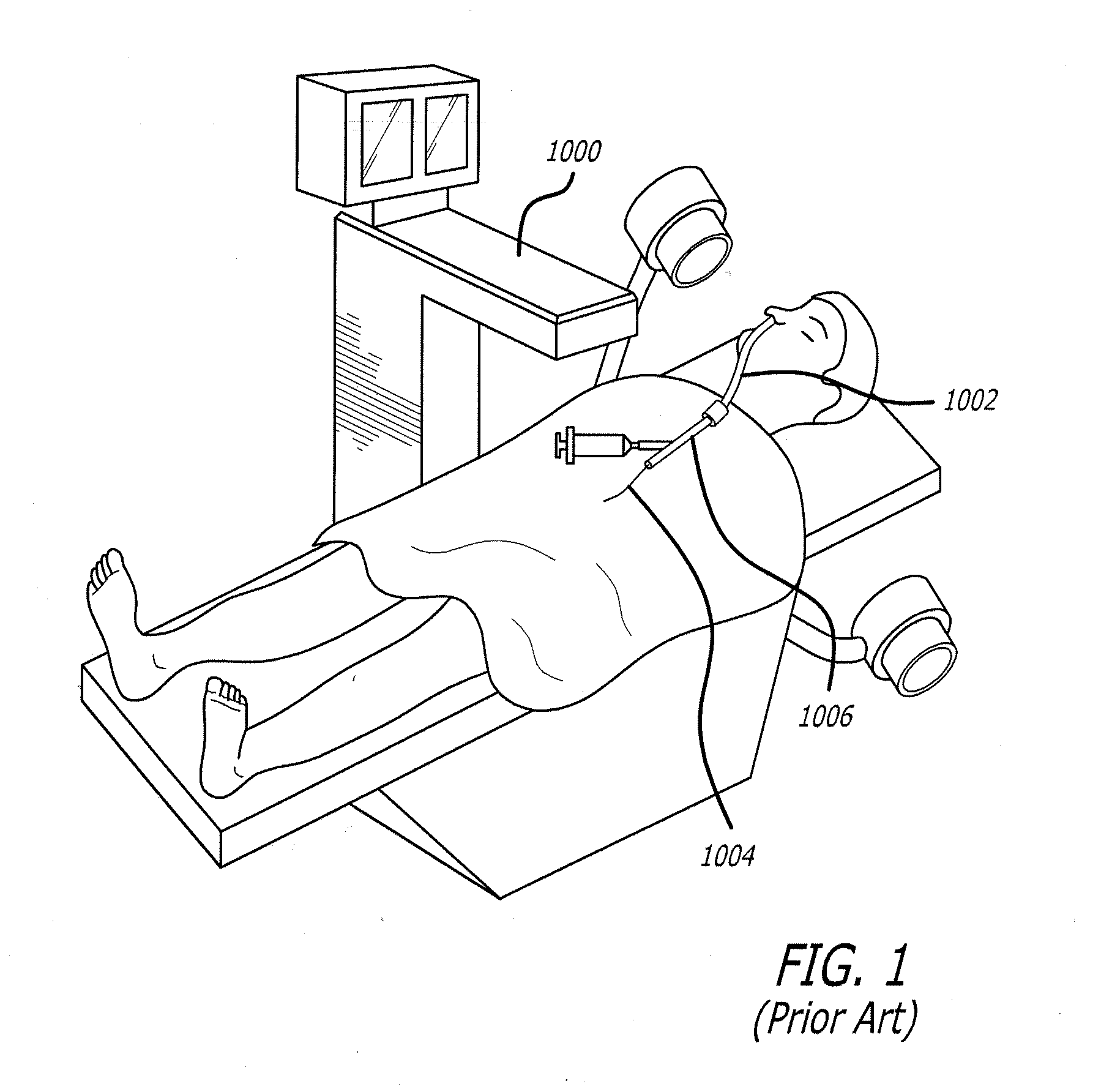Paranasal Ostium Finder Devices and Methods