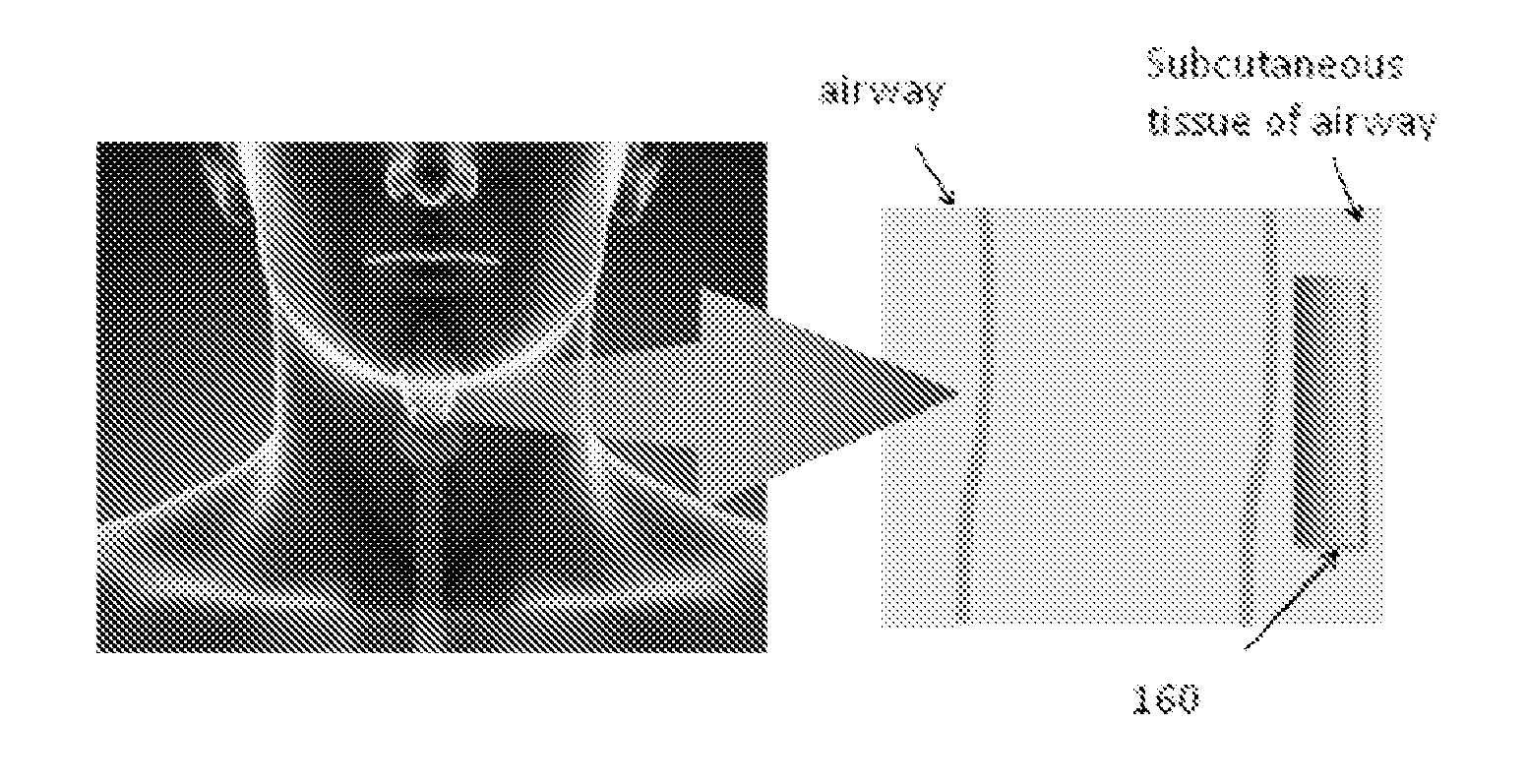 Device for supplementing voice and method for controlling the same