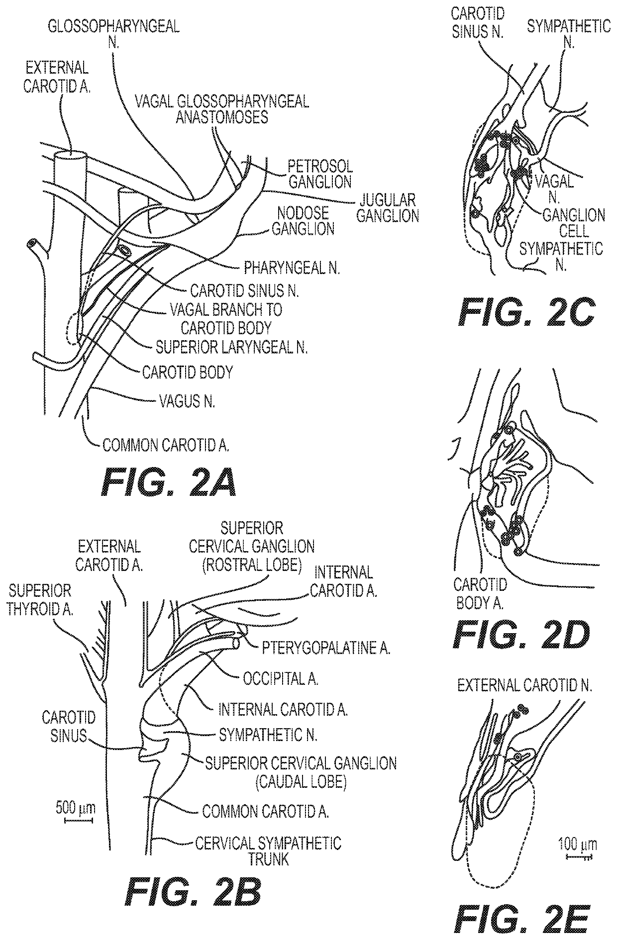 Neuromodulation device