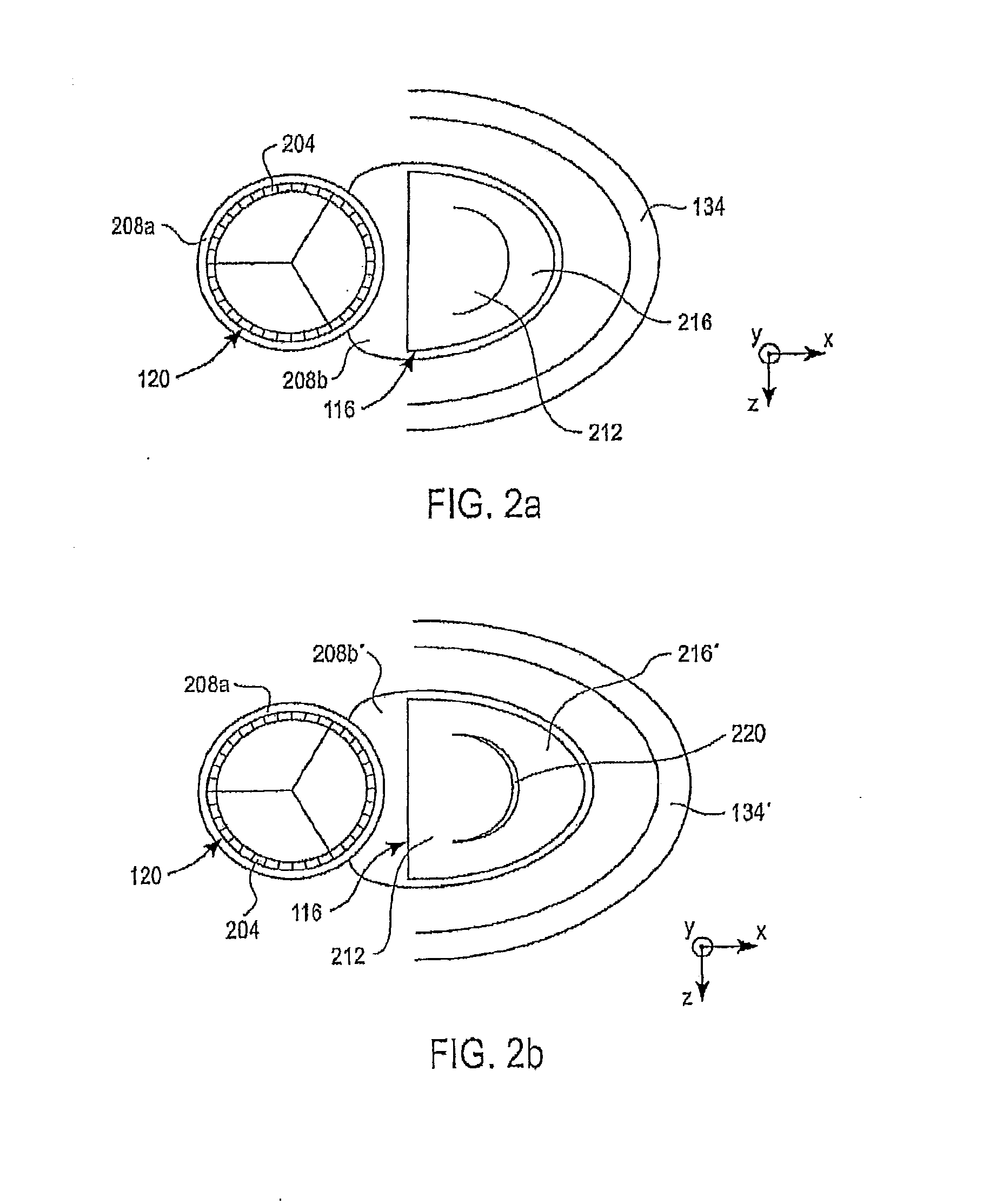 Catheter-based annuloplasty using ventricularly positioned catheter