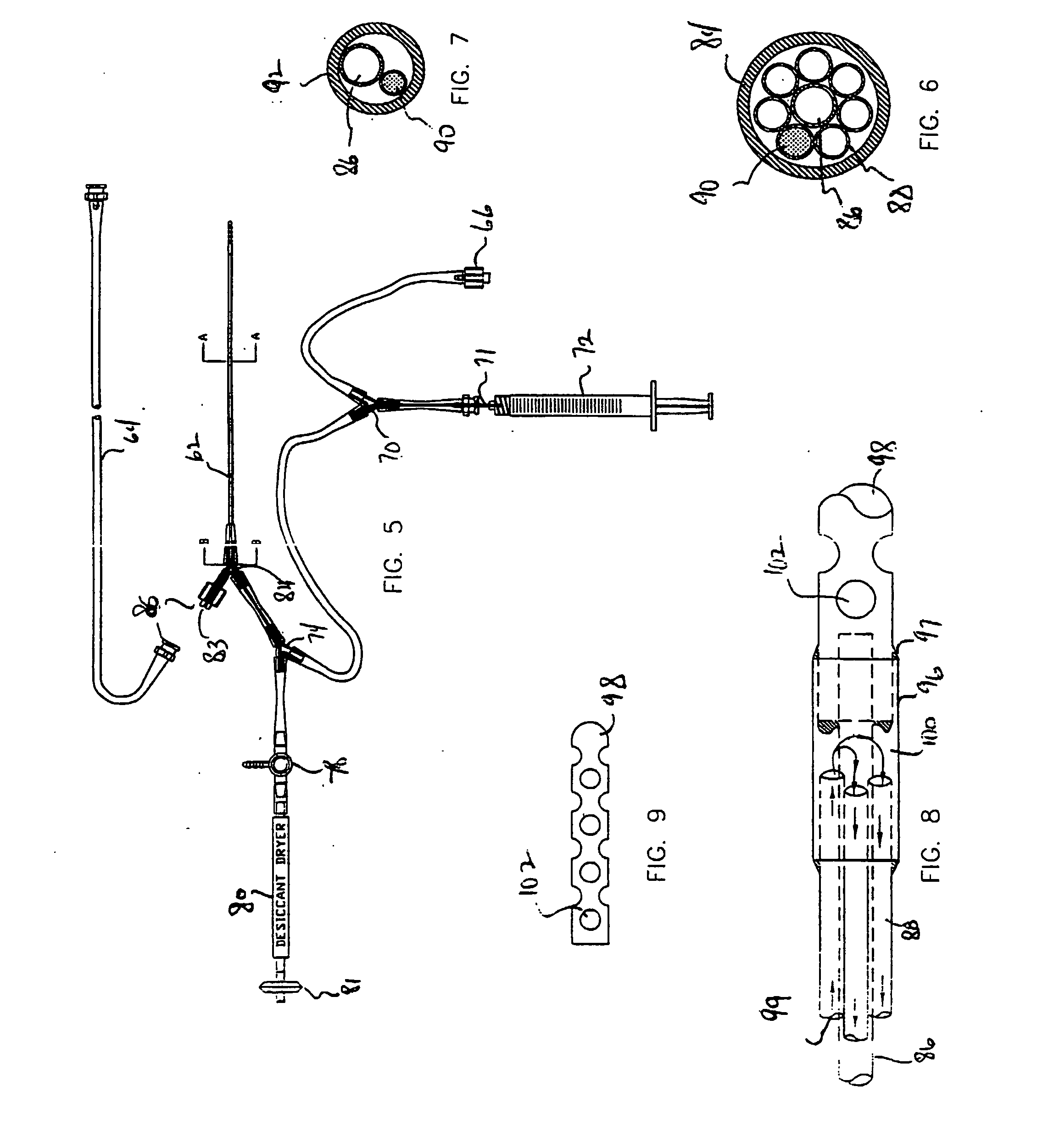 Method and system for treating tissue swelling