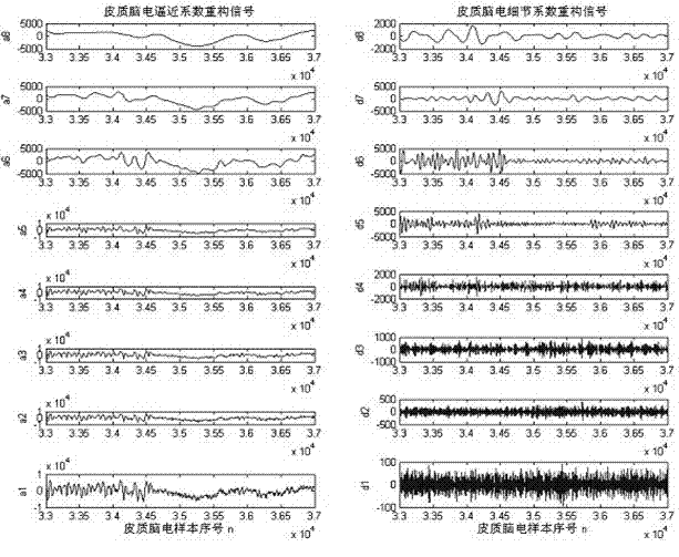 Intraoperative motor area function localization system based on multi-mode electroencephalogram wavelet analysis