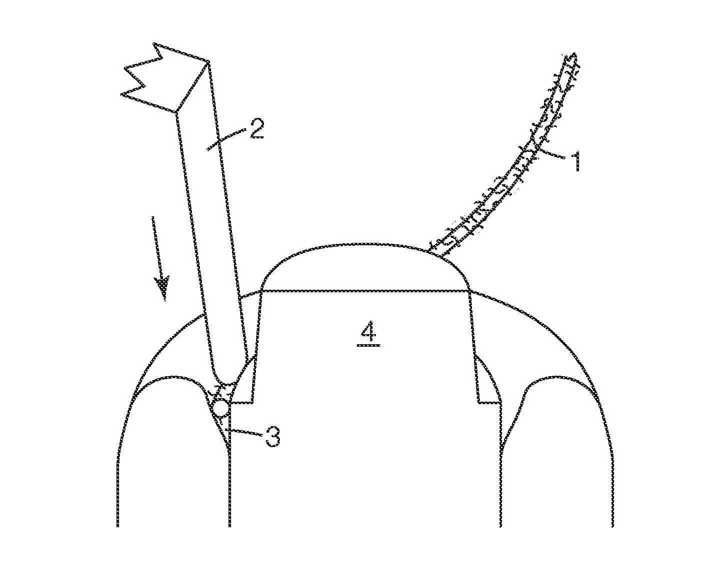 Dental Retraction Device and Process of its Production