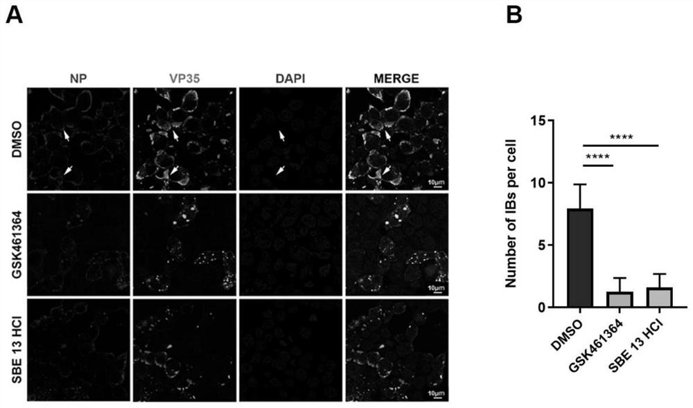 Application of PLK1 as target spot in preparation of medicine for treating Ebola virus diseases