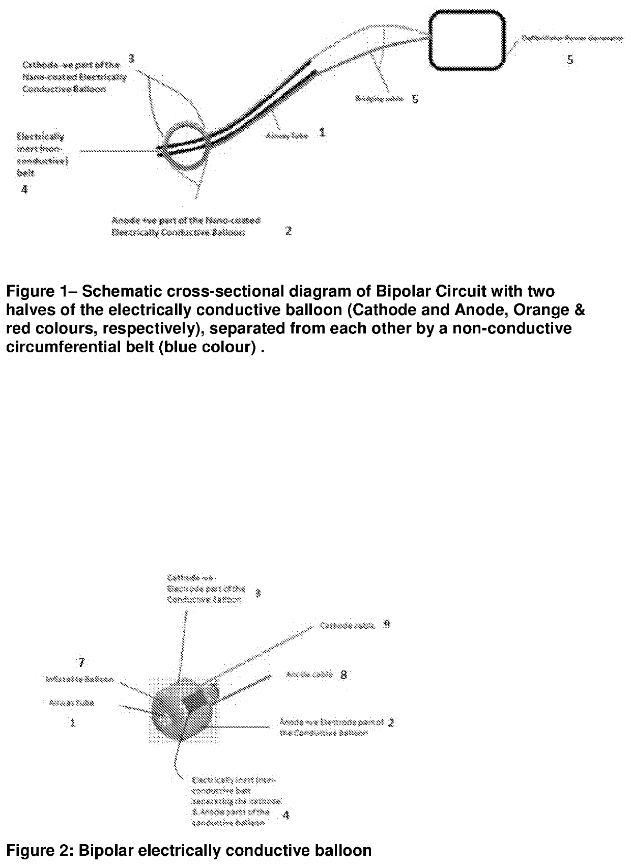 Airway cardioverter-defibrillator system