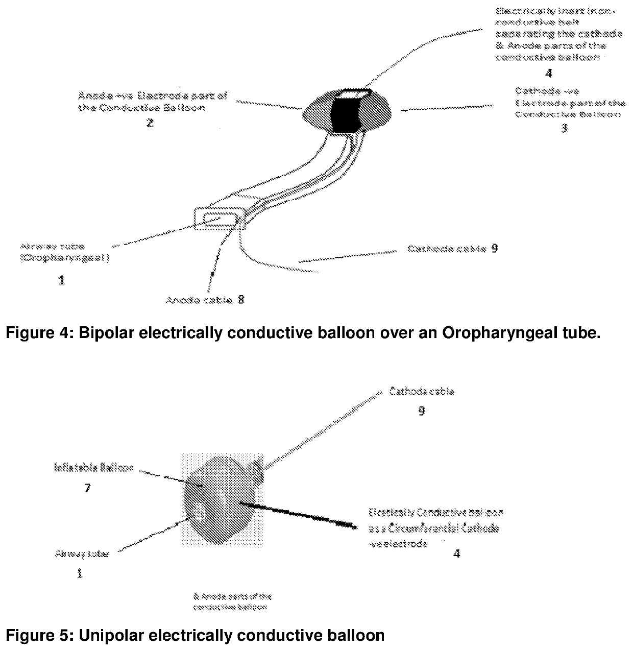 Airway cardioverter-defibrillator system