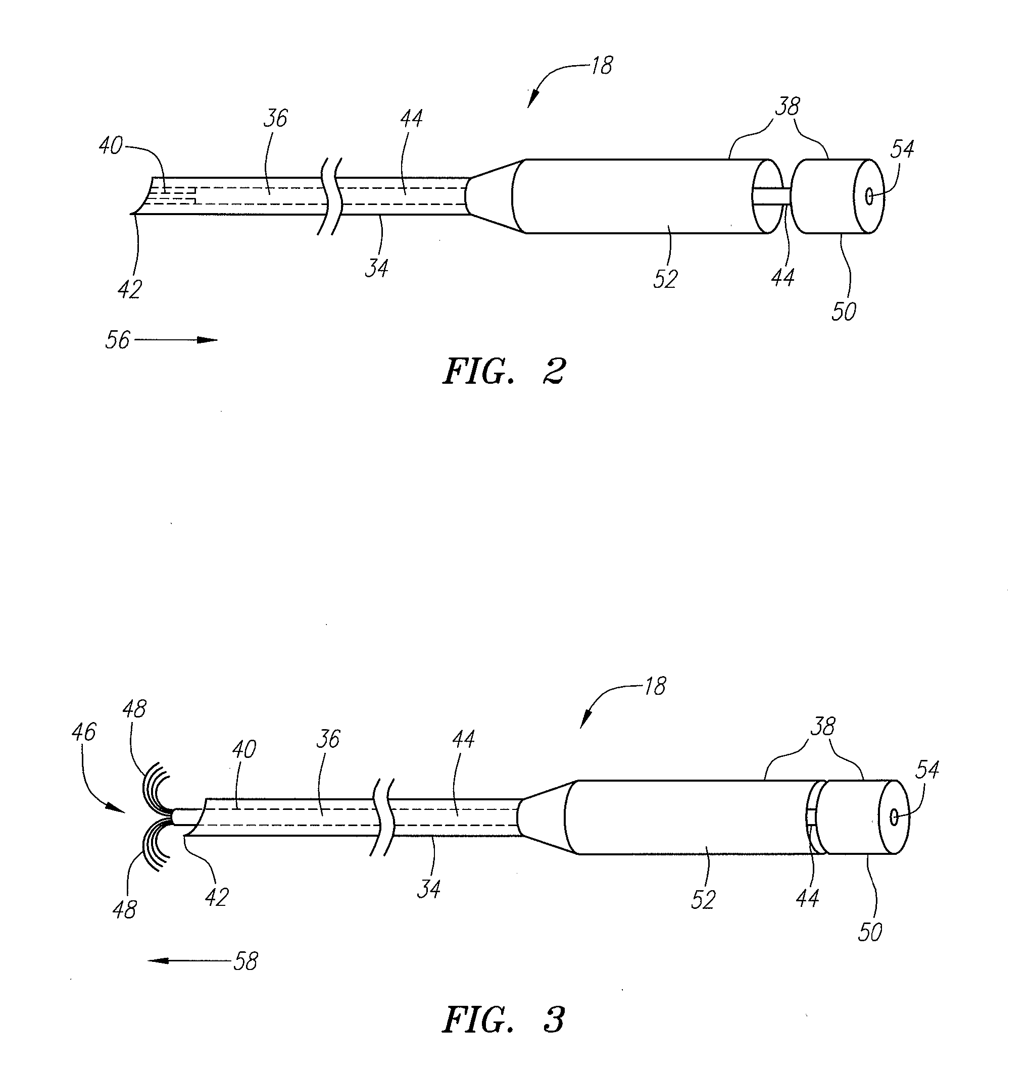 Radiation ablation tracking system and method