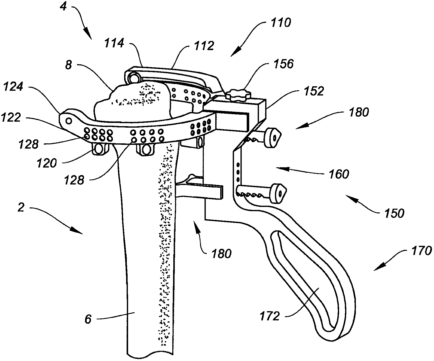 Navigation and positioning instruments for joint repair