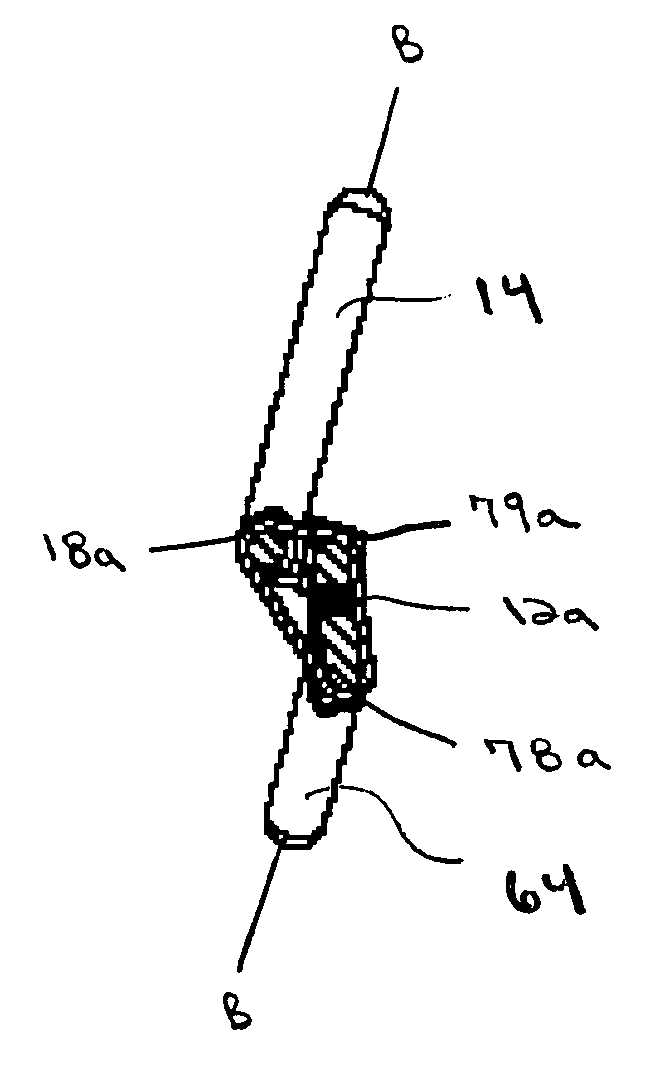 Non-linear artificial ligament system