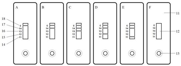 Mouse hybridoma cells and rapid diagnosis test strip for distinguishing and detecting plasmodium falciparum, plasmodium vivax, plasmodium malaria and plasmodium ovale