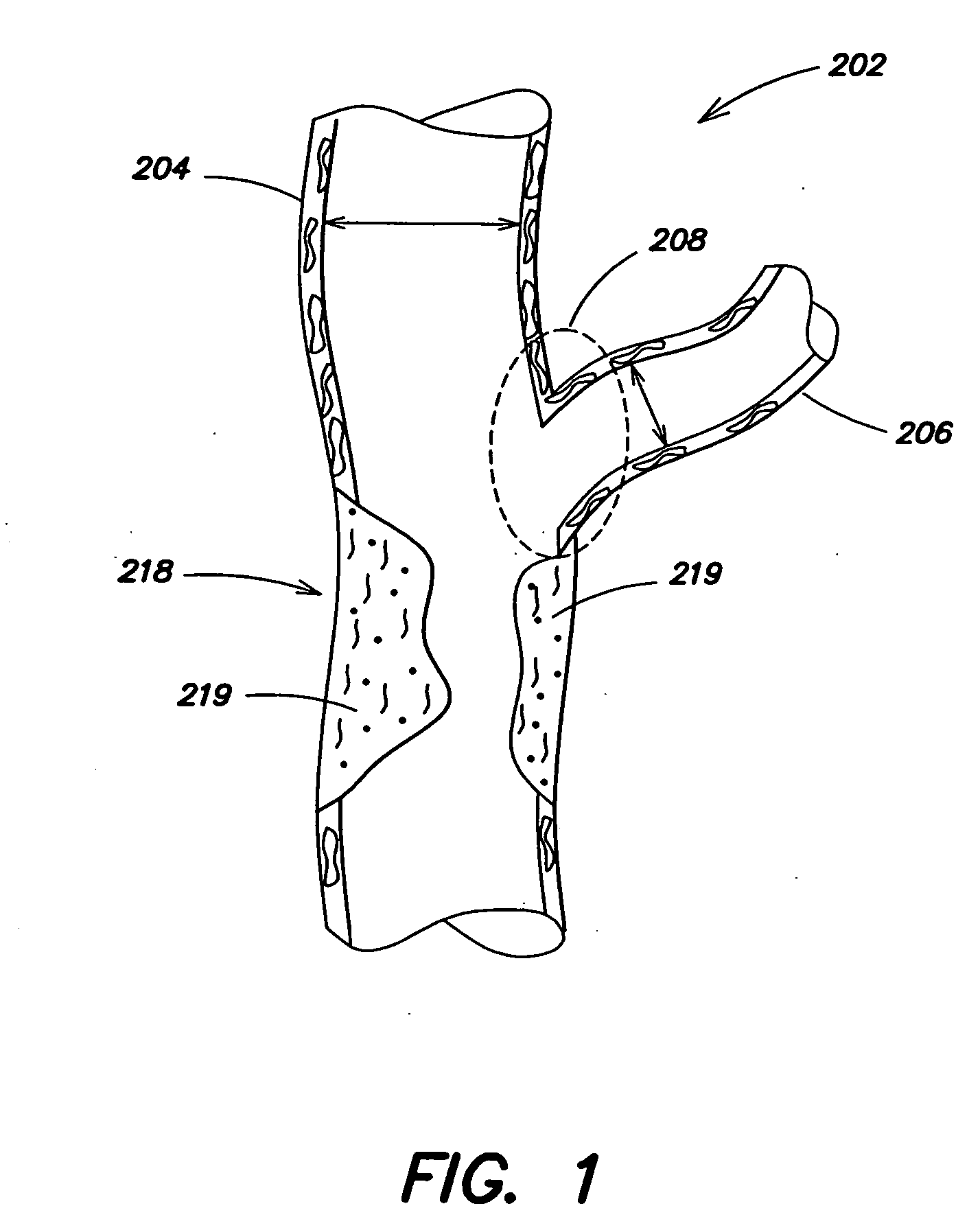 Segmented ostial protection device